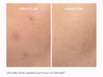 بوستر شات روشن کننده و ترانگزامیک اسید آرنسیا - تصویر 2